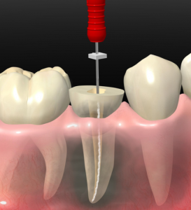 especialistas encias punta cana Tu Dentista RD