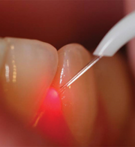 cursos odontologia punta cana Tu Dentista RD